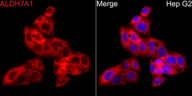 100UL ALDH7A1 ANTIBODY 100 ul