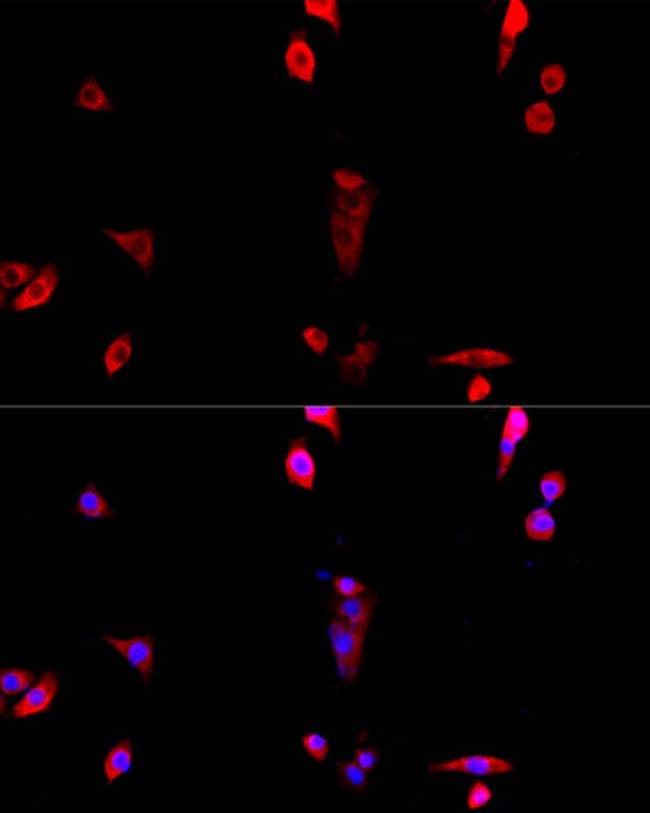 100UL EIF3J ANTIBODY 100 ul