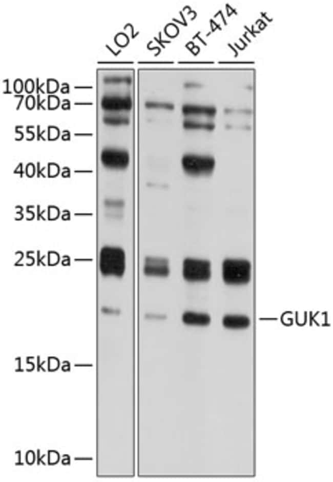 100UL GUK1 ANTIBODY 100 ul