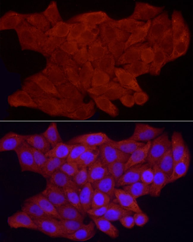 100UL FHL3 ANTIBODY 100 ul