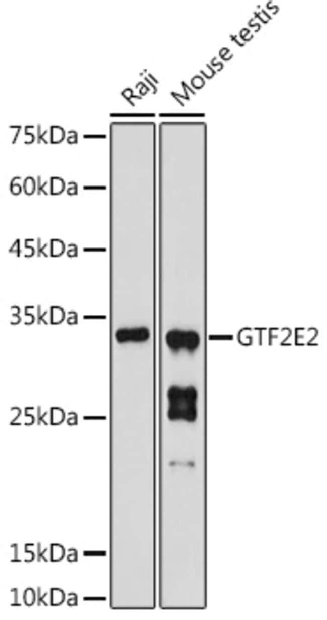 100UL GTF2E2 ANTIBODY 100 ul