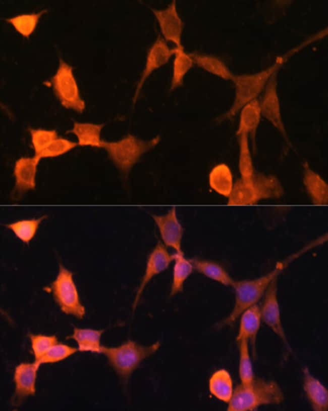 100UL CALCYCLIN ANTIBODY 100 ul