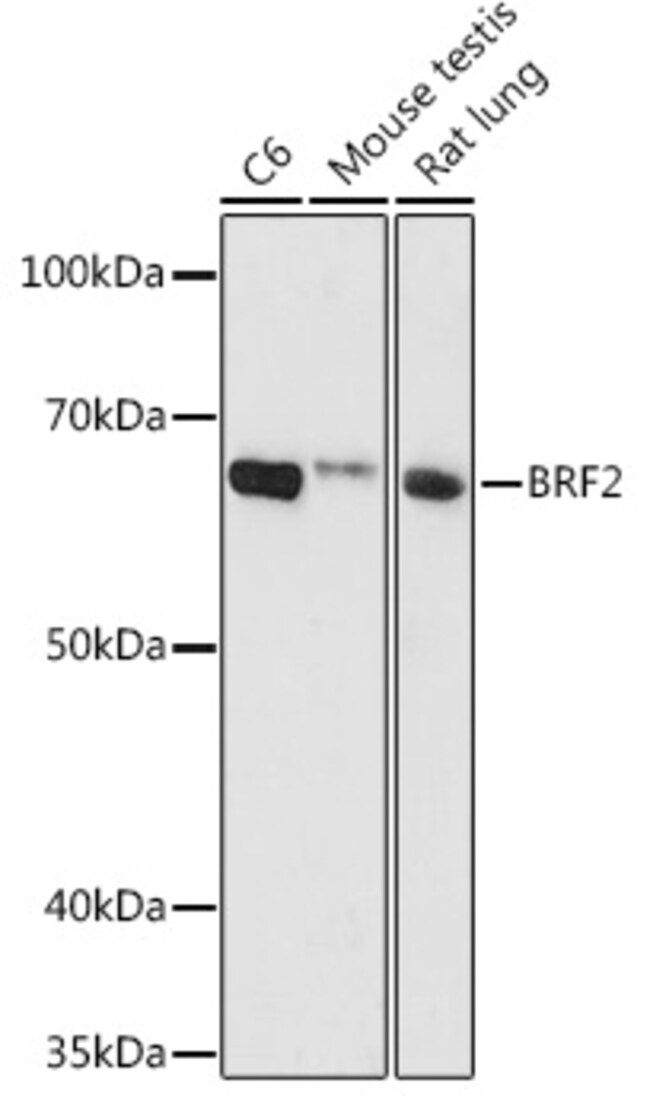 100UL BRF2 ANTIBODY 100 ul