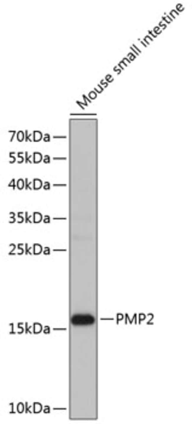 100UL FABP8 ANTIBODY 100 ul