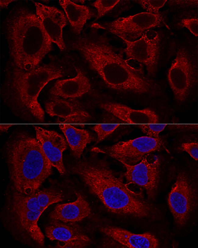 100UL ARL8B ANTIBODY 100 ul