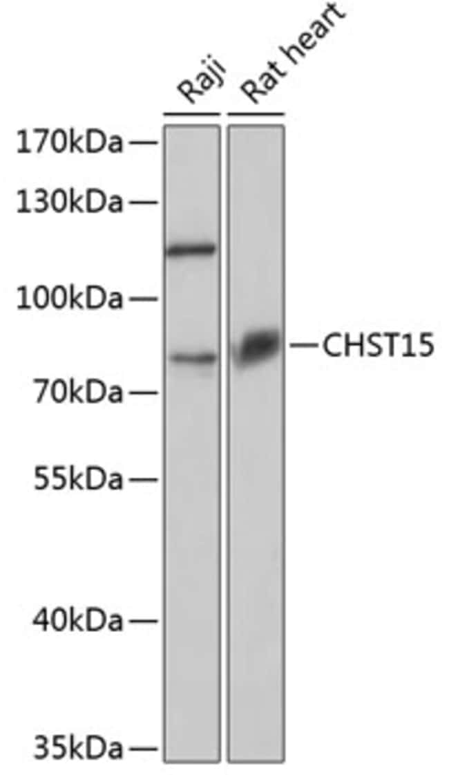 100UL CHST15 ANTIBODY 100 ul
