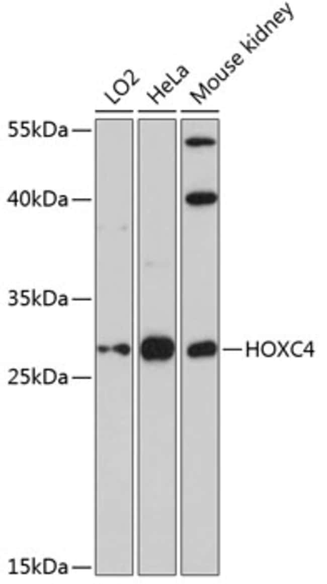 100UL HOXC4 ANTIBODY 100 ul