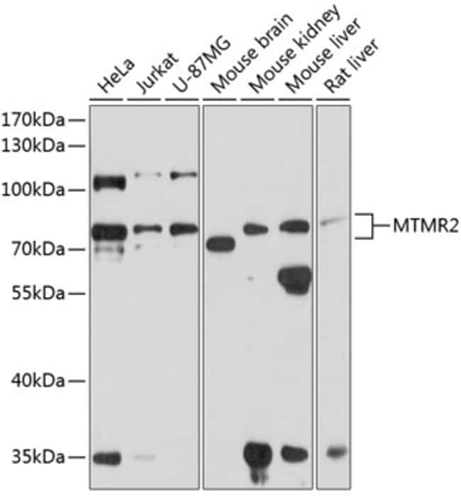 100UL MTMR2 ANTIBODY 100 ul