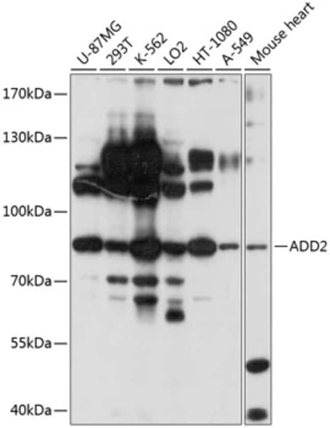 100UL BETA ADDUCIN ANTIBODY 100 ul