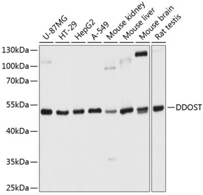 100UL DDOST ANTIBODY 100 ul