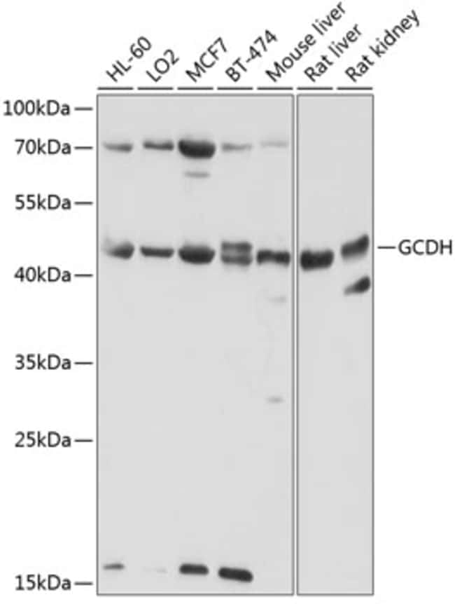 100UL GCDH ANTIBODY 100 ul