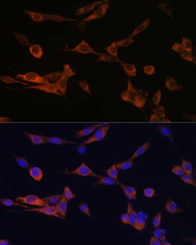 100UL 14-3-3 ETA ANTIBODY 100 ul