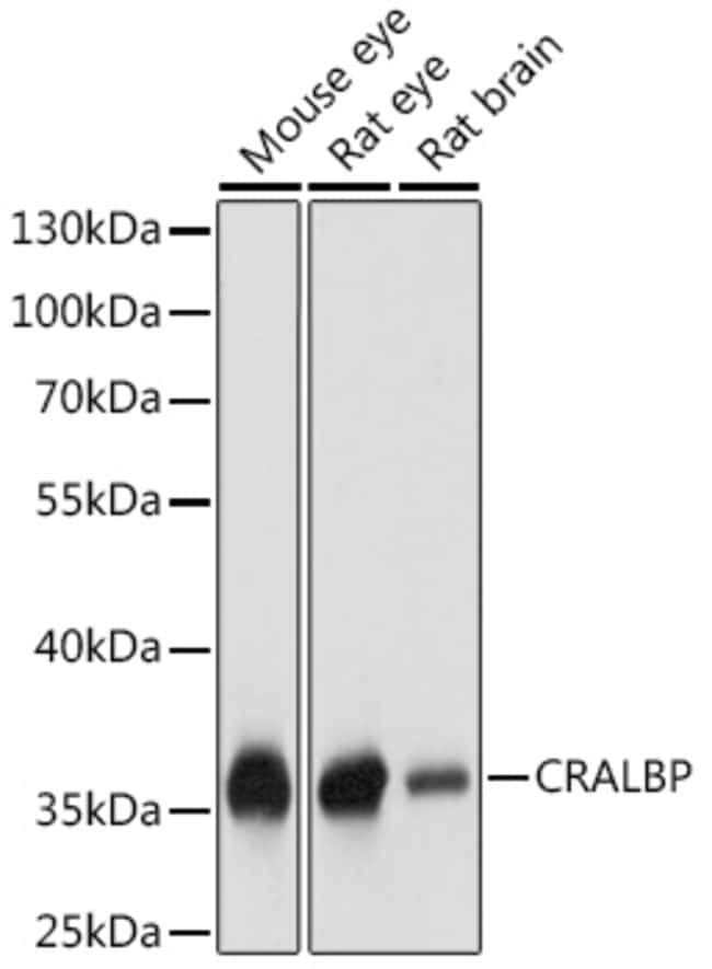 100UL CRALBP ANTIBODY 100 ul