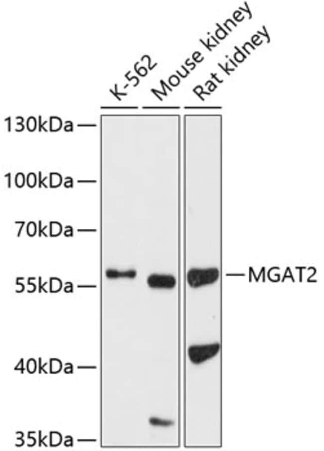 100UL MGAT2 ANTIBODY 100 ul