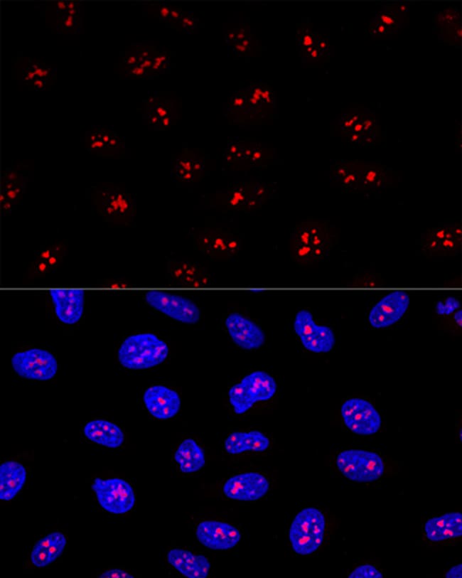 100UL EBNA1BP2 ANTIBODY 100 ul