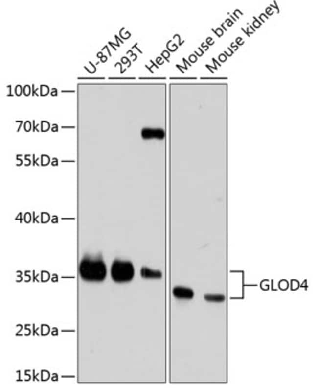 100UL C17ORF25 ANTIBODY 100 ul