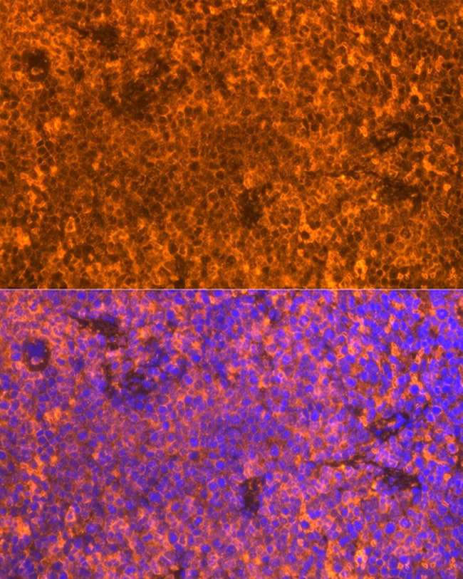 100UL FAM65B ANTIBODY 100 ul