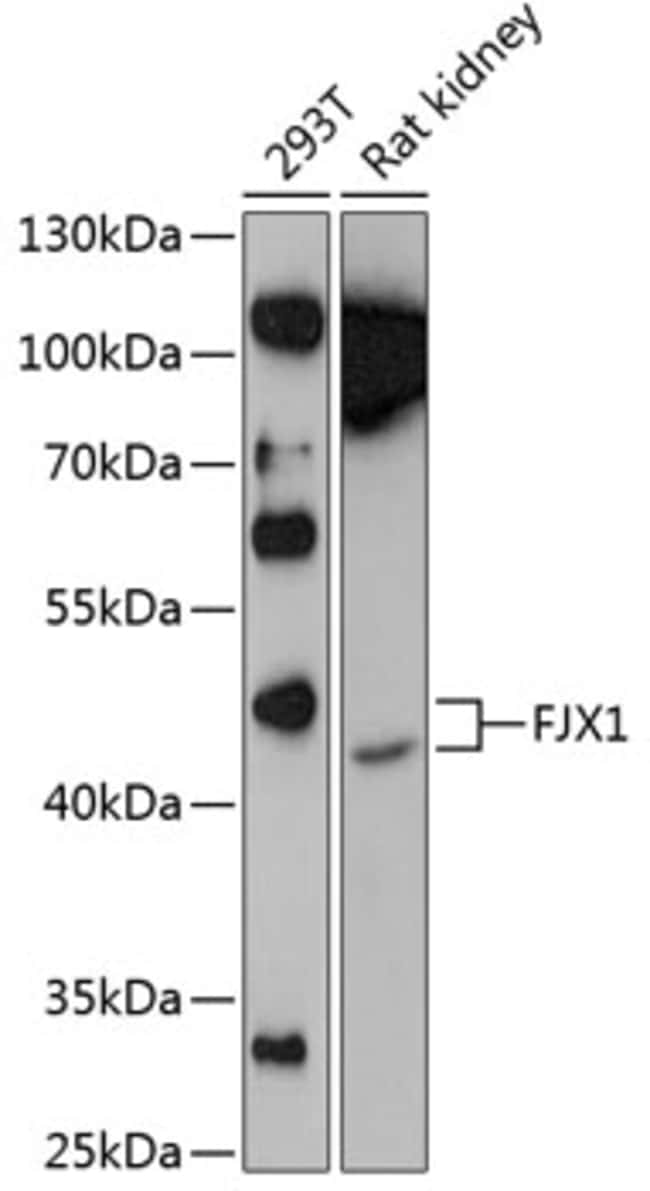 100UL FJX1 ANTIBODY 100 ul