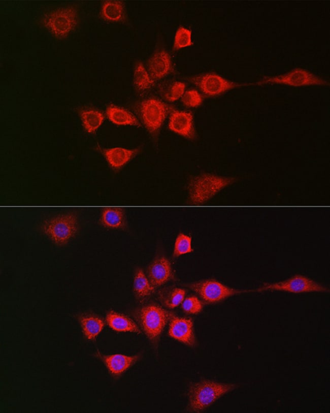 100UL METTL4 ANTIBODY 100 ul