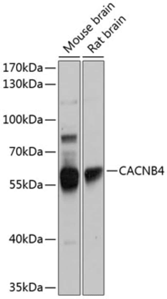 100UL CALCIUM CHANNEL BETA-4 ANTIBOD 100