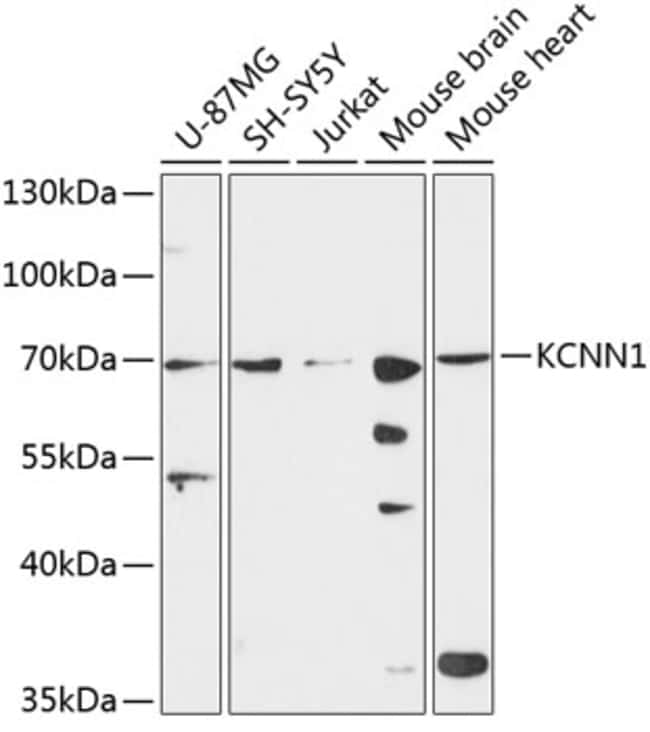 100UL KCNN1 ANTIBODY 100 ul