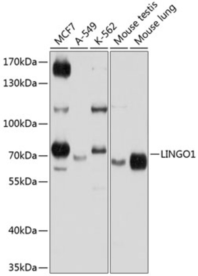 100UL LINGO1 ANTIBODY 100 ul