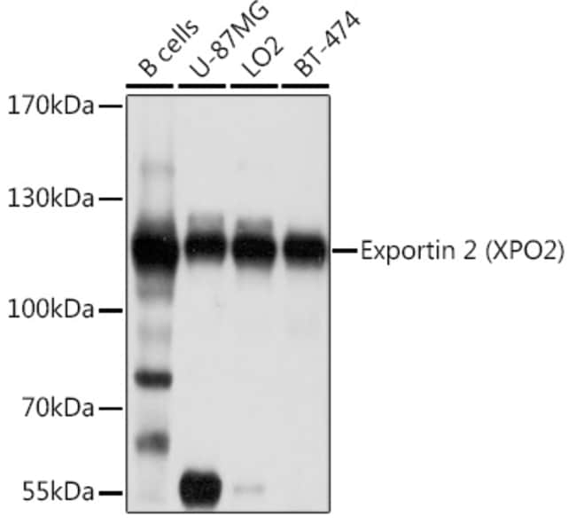 100UL CAS ANTIBODY 100 ul