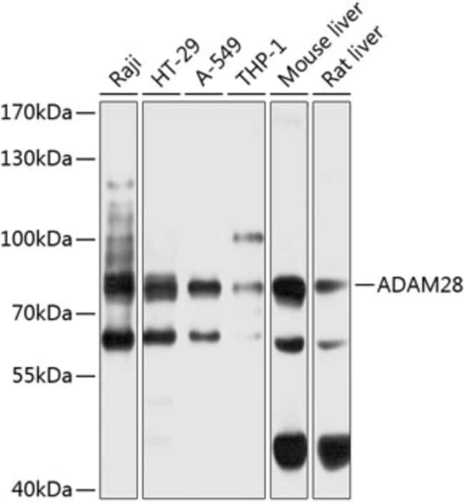 100UL ADAM28 ANTIBODY 100 ul