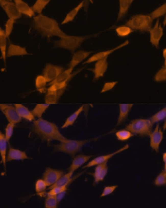 100UL DSK2 ANTIBODY 100 ul