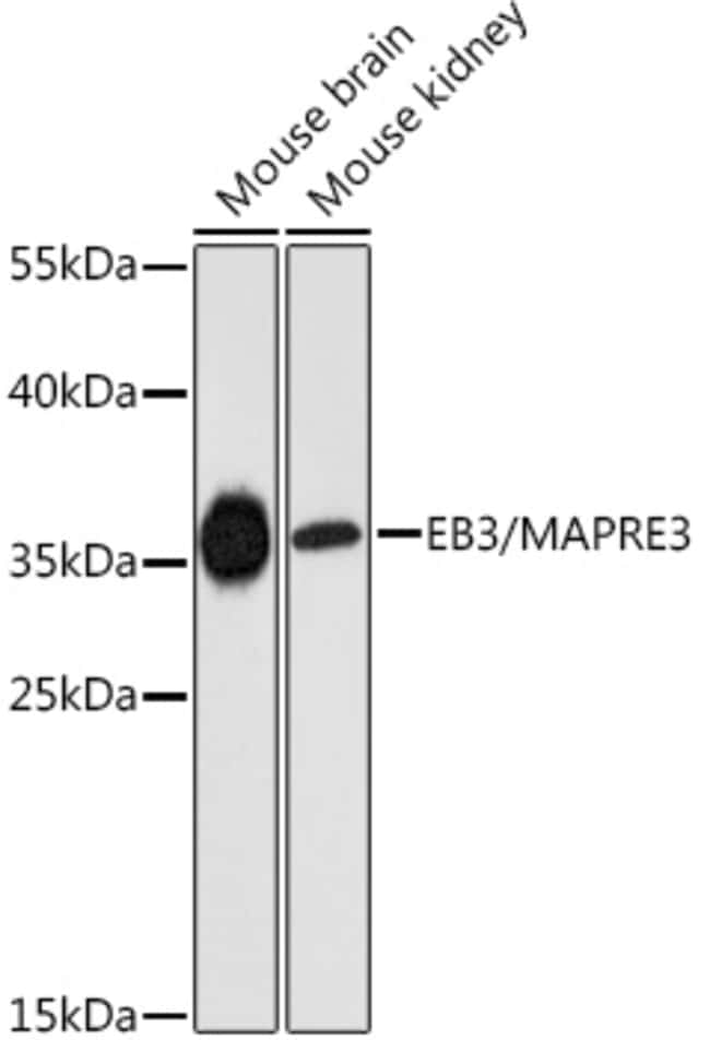 100UL MAPRE3 ANTIBODY 100 ul