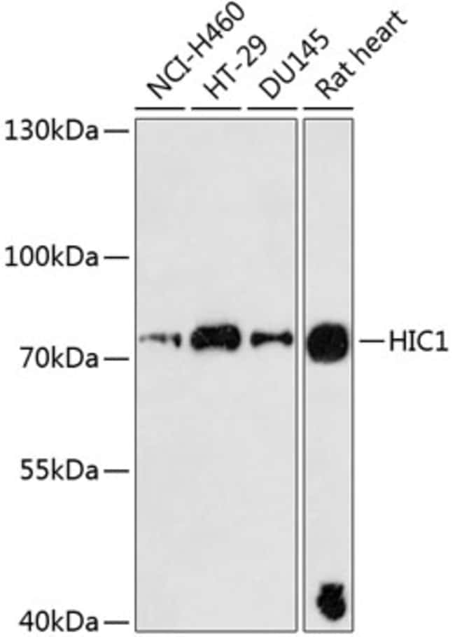 100UL HIC1 ANTIBODY 100 ul