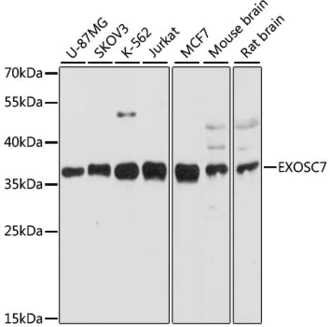100UL EXOSC7 ANTIBODY 100 ul