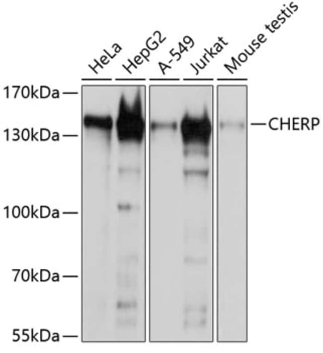 100UL CHERP ANTIBODY 100 ul