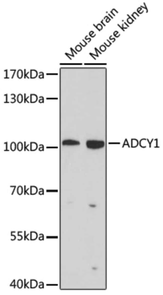 100UL ADCY1 ANTIBODY 100 ul