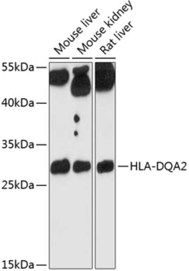 100UL HLA-DQA2 ANTIBODY 100 ul
