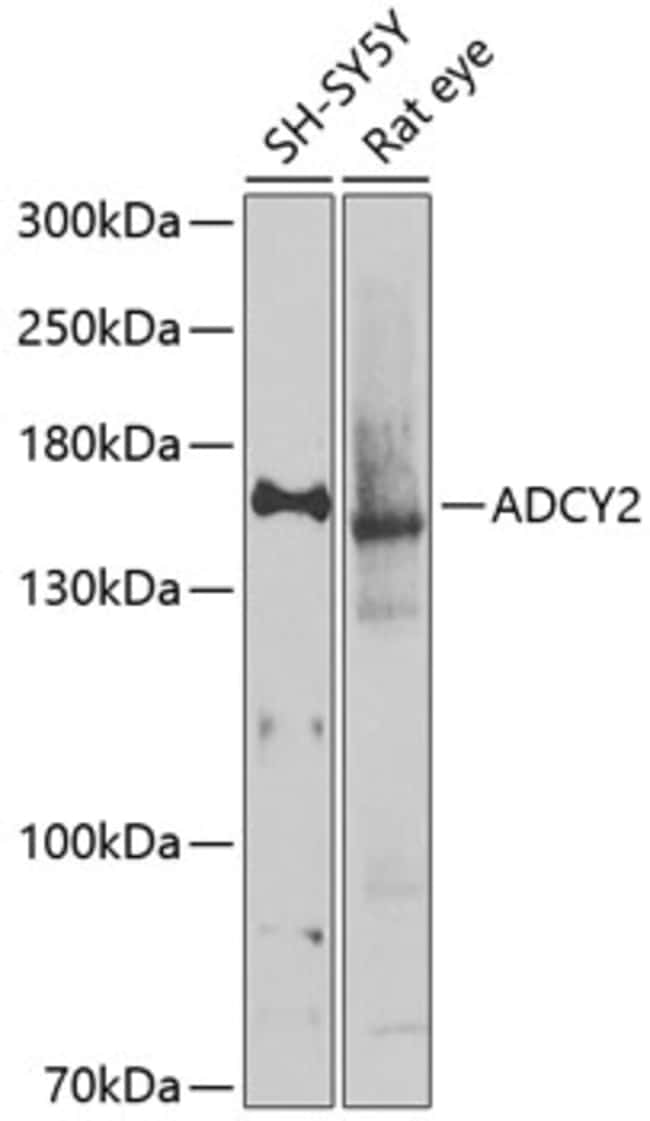 100UL ADCY2 ANTIBODY 100 ul