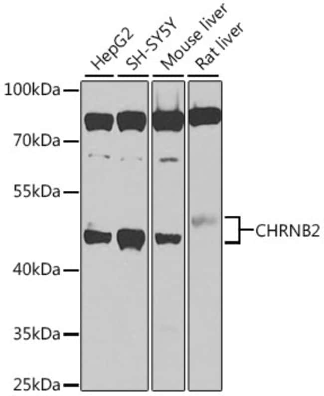 100UL CHRNB2 ANTIBODY 100 ul