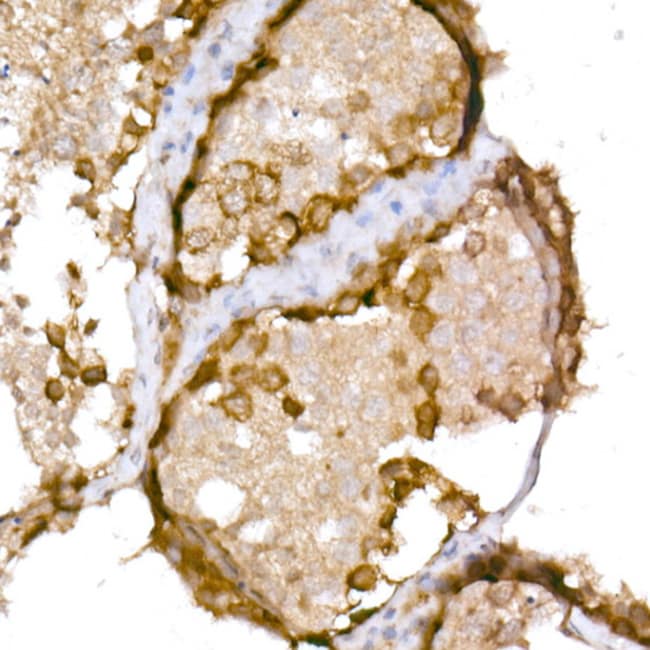 100UL CTAG1B ANTIBODY 100 ul