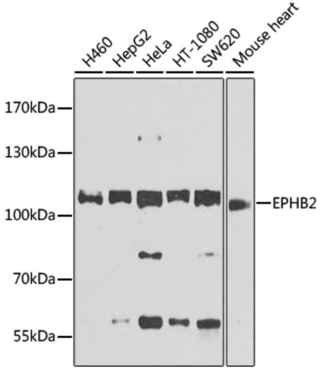 100UL EPHB2 ANTIBODY 100 ul