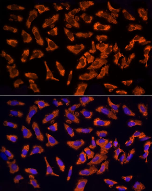 100UL EPS15 ANTIBODY 100 ul