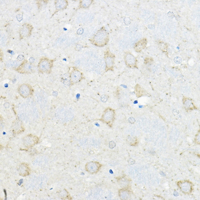 100UL GIPR ANTIBODY 100 ul