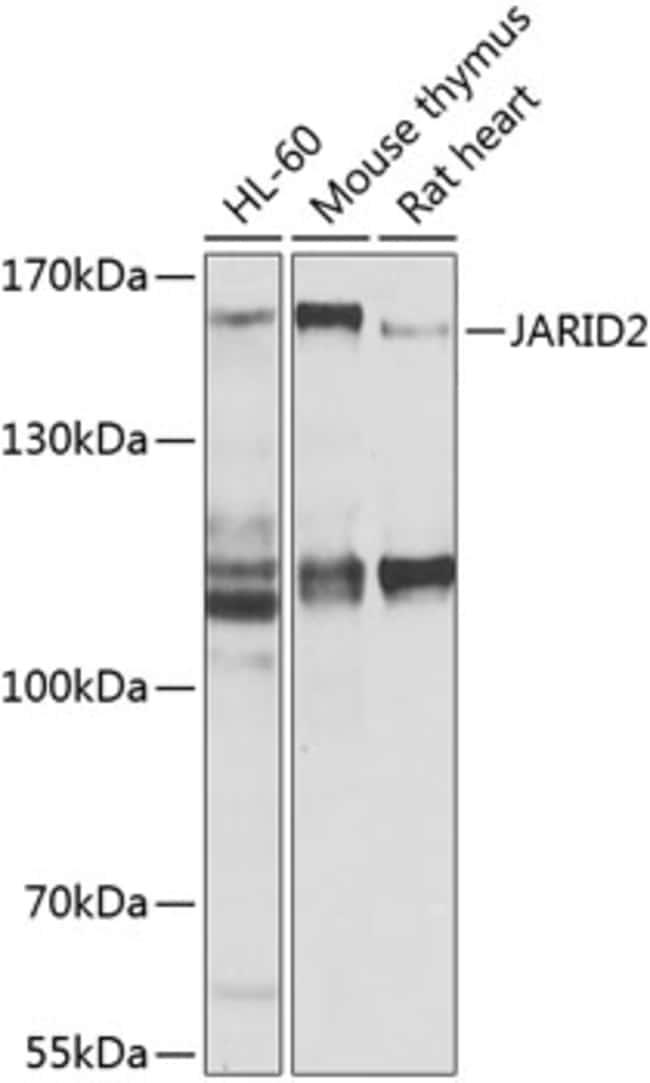 100UL JARID2 ANTIBODY 100 ul