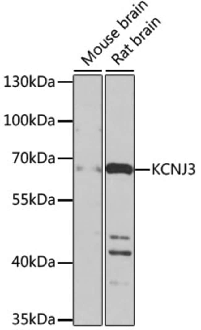 100UL KIR3.1 (KCNJ3) ANTIBODY 100 ul