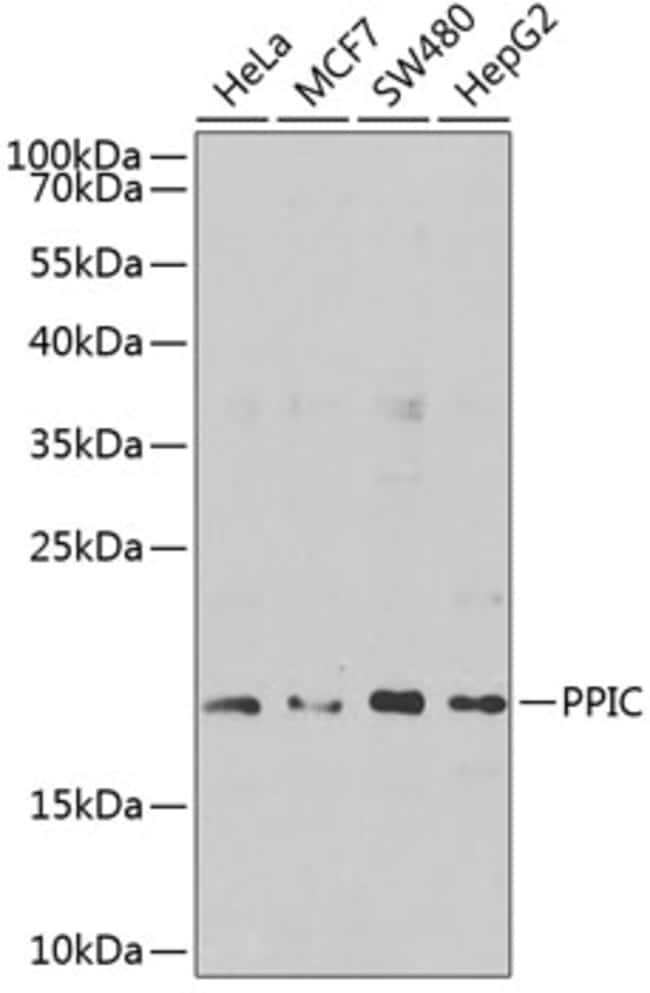 100UL CYCLOPHILIN C ANTIBODY 100 ul