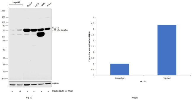 100UL GLUT2 ANTIBODY 100 ul