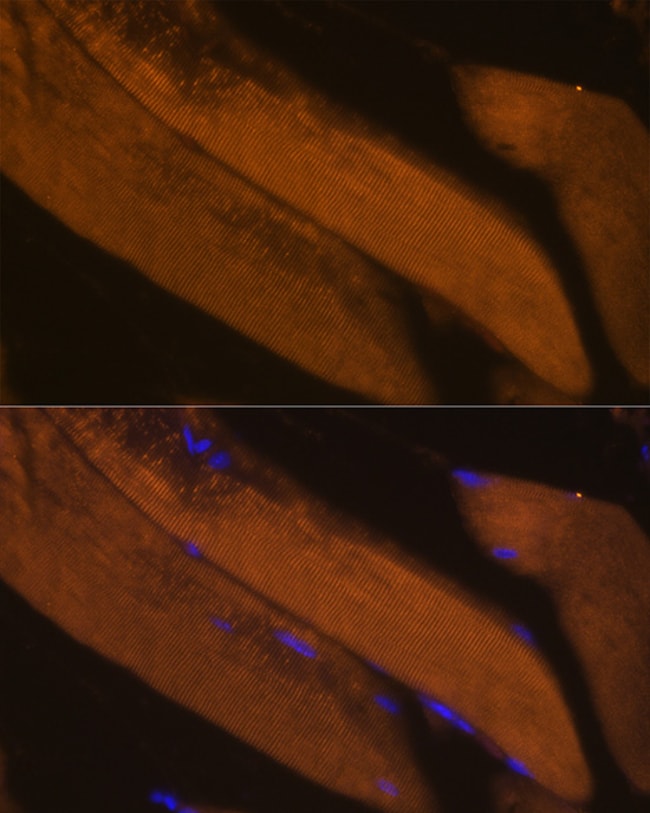 100UL FBP2 ANTIBODY 100 ul