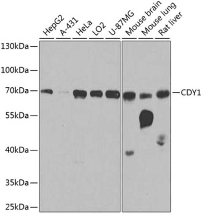 100UL CDY1 ANTIBODY 100 ul