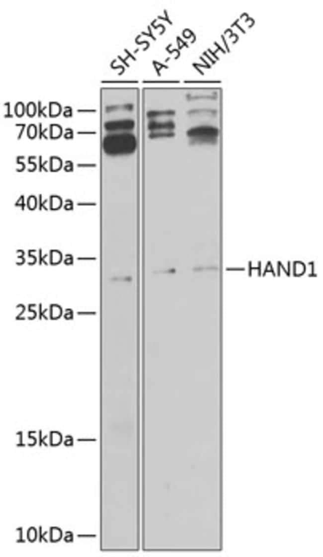 100UL HAND1 ANTIBODY 100 ul