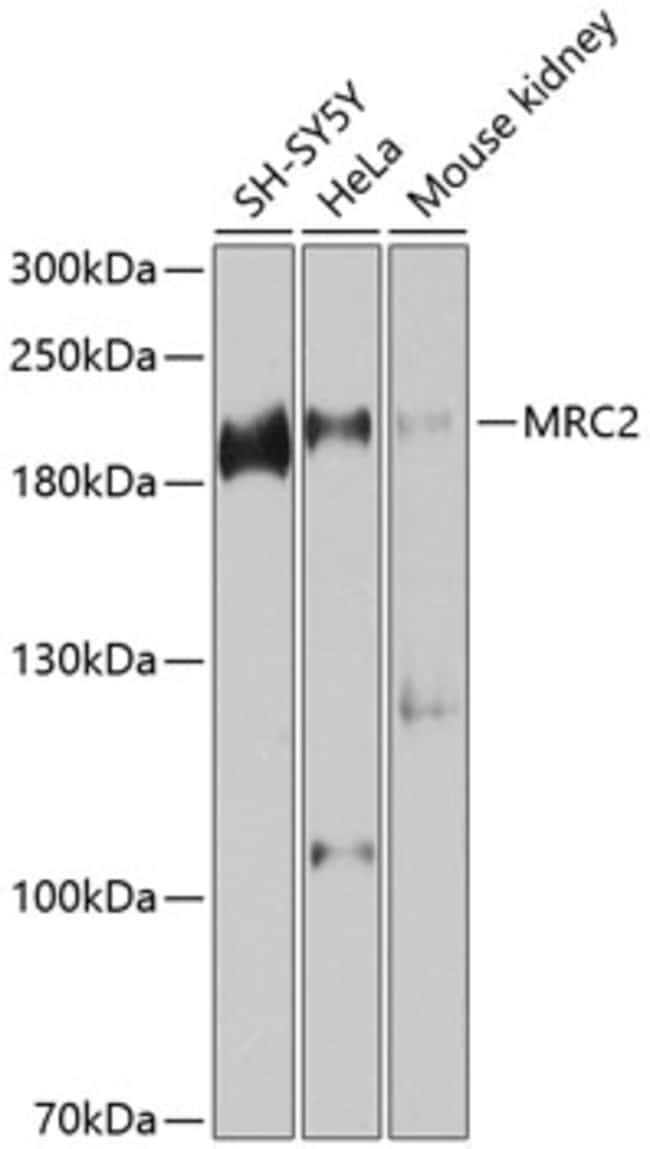100UL MRC2 ANTIBODY 100 ul