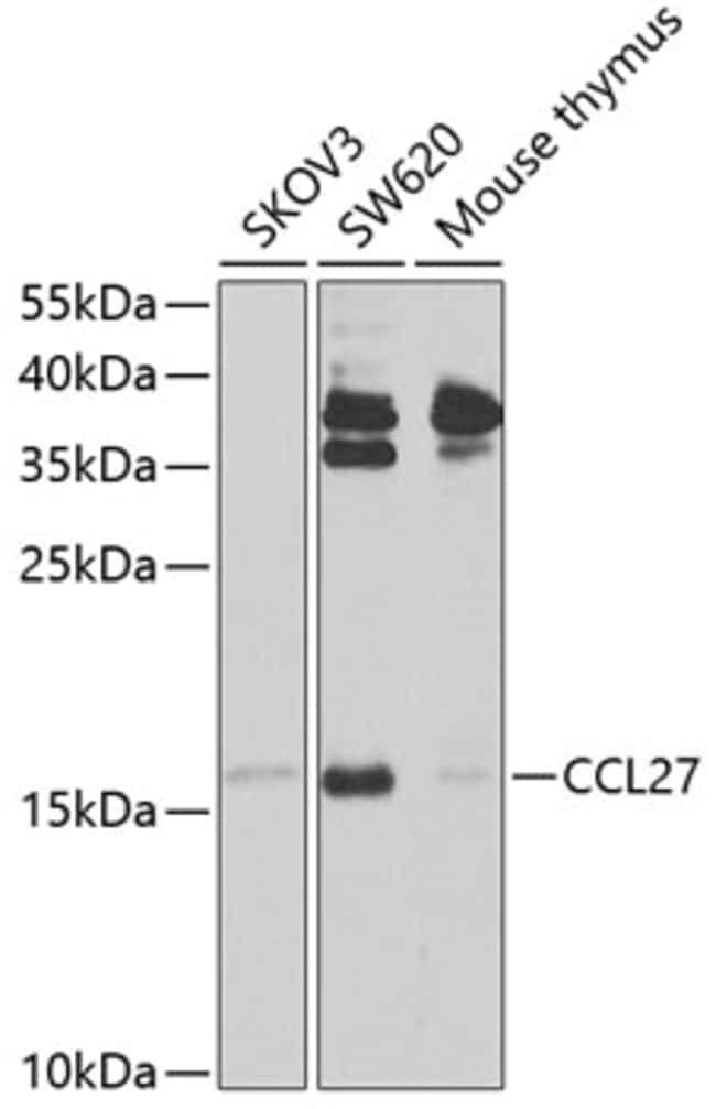 100UL CCL27 ANTIBODY 100 ul